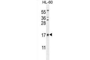 Western Blotting (WB) image for anti-Cornichon Homolog 2 (CNIH2) antibody (ABIN2996238) (CNIH2 Antikörper)