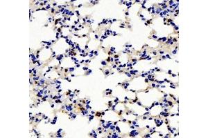 Immunohistochemistry of paraffin embedded mouse pneumonia using IL-2 Receptor alpha (ABIN7074349) at dilution of 1: 500 (400x lens) (CD25 Antikörper)