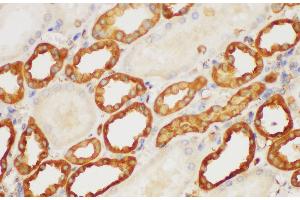 Immunohistochemistry of paraffin-embedded Human kidney using S100A6 Polycloanl Antibody at dilution of 1:150