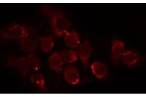 Immunofluorescence (fixed cells) (IF/ICC) image for anti-Cytochrome P450, Family 24, Subfamily A, Polypeptide 1 (CYP24A1) (C-Term) antibody (ABIN6258419)