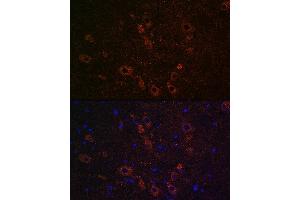 Immunofluorescence analysis of rat brain using SLC5 Rabbit pAb (ABIN7267643) at dilution of 1:100 (40x lens). (ChT Antikörper  (AA 421-580))
