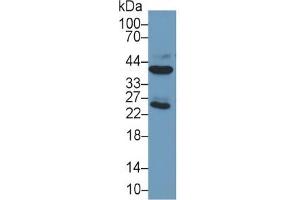 Mouse Capture antibody from the kit in WB with Positive Control: Sample Human Liver lysate;. (ARG ELISA Kit)