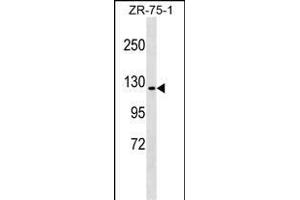 ERN1 Antibody (C-term) (ABIN1537620 and ABIN2849317) western blot analysis in ZR-75-1 cell line lysates (35 μg/lane). (ERN1 Antikörper  (C-Term))