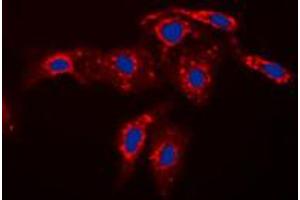Immunofluorescent analysis of Caspase 7 p11 staining in HEK293T cells. (Caspase 7 p11 (Center) Antikörper)