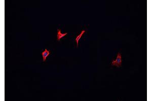 ABIN6266695 staining MCF-7 cells by IF/ICC. (HGS Antikörper  (Internal Region))