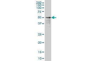 ZNF213 monoclonal antibody (M01), clone 5D7 Western Blot analysis of ZNF213 expression in A-431 . (ZNF213 Antikörper  (AA 133-242))