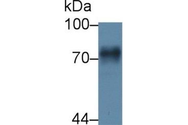 Prothrombin Fragment 1+2 Antikörper  (AA 44-323)