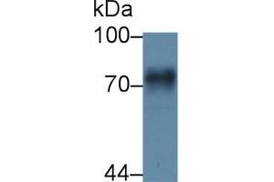 Detection of F1+2 in Rat Liver lysate using Polyclonal Antibody to Prothrombin Fragment 1+2 (F1+2) (Prothrombin Fragment 1+2 Antikörper  (AA 44-323))