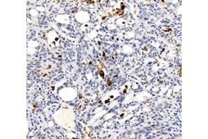 Immunohistochemistry (Paraffin-embedded Sections) (IHC (p)) image for anti-Caspase 3 (CASP3) (cleaved) antibody (ABIN7073336)