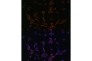 Immunofluorescence analysis of NIH/3T3 cells using DYNLL2 antibody (ABIN6130318, ABIN6139893, ABIN6139895 and ABIN6218049) at dilution of 1:100. (DYNLL2 Antikörper  (AA 1-89))