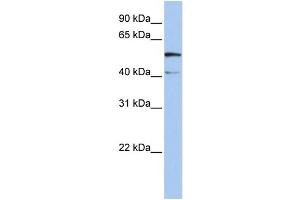 WB Suggested Anti-SLC23A3 Antibody Titration:  0. (SLC23A3 Antikörper  (N-Term))