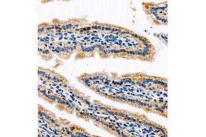 Immunohistochemistry of paraffin embedded mouse small intestine using AnnexinA13 (ABIN7073061) at dilution of 1:1500 (400x lens) (Annexin A13 Antikörper)