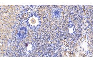 Immunohistochemistry (IHC) image for anti-Myosin Heavy Chain 11, Smooth Muscle (MYH11) (AA 1-351) antibody (ABIN7445579)
