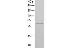 SMAD4 Protein (AA 13-227) (His tag)