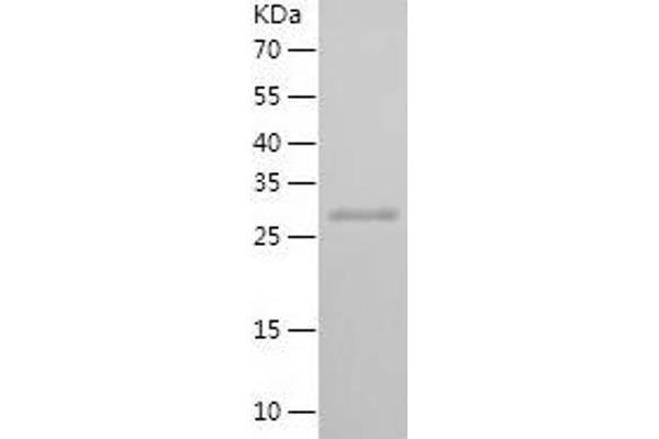 SMAD4 Protein (AA 13-227) (His tag)