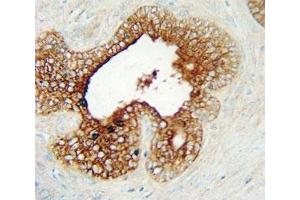 Immunohistochemistry (IHC) image for anti-Lymphocyte-Activation Gene 3 (LAG3) (AA 103-132) antibody (ABIN3028809)