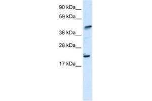 Western Blotting (WB) image for anti-IKAROS Family Zinc Finger 5 (Pegasus) (IKZF5) antibody (ABIN2460681) (IKZF5 Antikörper)