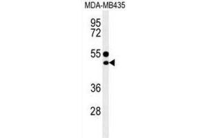 Western Blotting (WB) image for anti-CD1e (CD1e) antibody (ABIN3004387) (CD1e Antikörper)