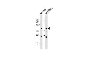All lanes : Anti-Epcam Antibody (C-term) at 1:2000 dilution Lane 1: mouse lung lysates Lane 2: mouse kidney lysates Lysates/proteins at 20 μg per lane. (EpCAM Antikörper  (C-Term))