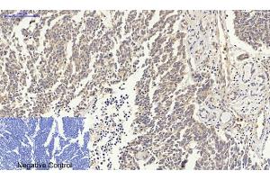 Immunohistochemical analysis of paraffin-embedded human lung cancer tissue.