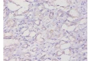 Immunohistochemistry of paraffin-embedded human kidney tissue using ABIN7152720 at dilution of 1:20 (FTL Antikörper  (AA 2-175))