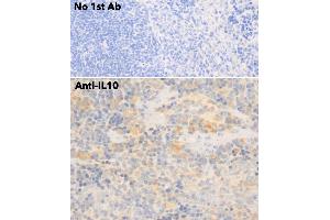 Immunohistochemistry (IHC) image for anti-Interleukin 10 (IL10) antibody (ABIN6254177) (IL-10 Antikörper)