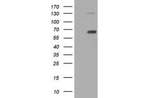 Western Blotting (WB) image for anti-Pyruvate Kinase, Liver and RBC (PKLR) antibody (ABIN1500245) (PKLR Antikörper)