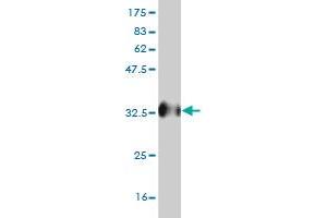 Western Blotting (WB) image for anti-Ubiquilin 2 (UBQLN2) (AA 555-624) antibody (ABIN565449)