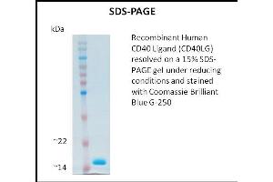 SDS-PAGE (SDS) image for CD40 Ligand (CD40LG) (Active) protein (ABIN5509293)