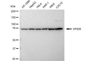 Western blotting analysis using VPS35 antibody (ABIN7800814).