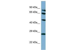 Host:  Rabbit  Target Name:  SV2B  Sample Type:  HT1080 Whole Cell lysates  Antibody Dilution:  1. (SV2B Antikörper  (C-Term))