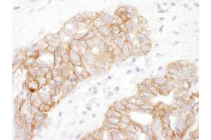 Immunohistochemistry (IHC) image for anti-Junction Plakoglobin (JUP) (AA 695-745) antibody (ABIN7454953)