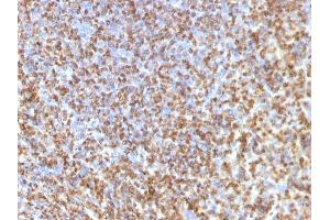 Formalin-fixed, paraffin-embedded human Spleen stained with Galectin-13 Monoclonal Antibody (PP13/1161). (LGALS13 Antikörper  (AA 23-134))