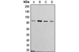 Western blot analysis of Cortactin expression in MCF7 (A), C6 (B), A431 (C), HeLa (D) whole cell lysates. (Cortactin Antikörper  (C-Term))