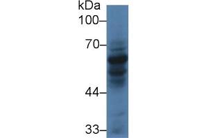 Detection of CARD9 in Human HL60 cell lysate using Polyclonal Antibody to Caspase Recruitment Domain Family, Member 9 (CARD9) (CARD9 Antikörper  (AA 26-283))