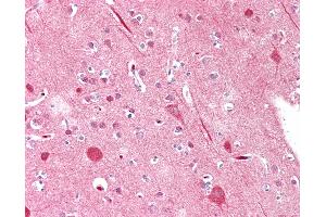 Anti-MYF5 / MYF 5 antibody IHC staining of human brain, cortex. (MYF5 Antikörper  (AA 7-36))