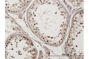 Immunoperoxidase of monoclonal antibody to CHEK2 on formalin-fixed paraffin-embedded human testis. (CHEK2 Antikörper  (AA 1-543))