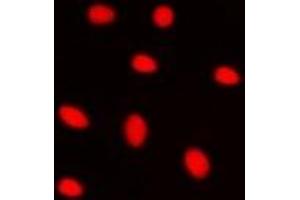 Immunofluorescent analysis of ZNF668 staining in HepG2 cells. (ZNF668 Antikörper)