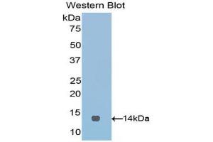 Western blot analysis of the recombinant protein. (VTCN1 Antikörper  (AA 34-147))