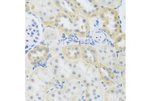Immunohistochemistry of paraffin-embedded rat kidney using SLC39A7 antibody (ABIN5971725) at dilution of 1/100 (40x lens). (SLC39A7 Antikörper)