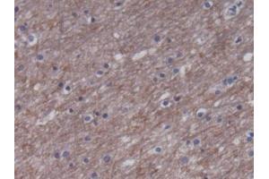 DAB staining on IHC-P; Samples: Human Cerebrum Tissue) (CKM Antikörper)