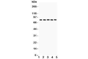 Western blot testing of Calpain antibody and Lane 1:  rat lung;  2: mouse lung;  3: human A549;  4: (h) COLO320;  5: (h) Jurkat. (Calpain Antikörper  (Catalytic Subunit))