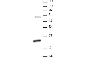 Histone H3 dimethyl Arg17 asymmetric antibody (pAb) tested by Western blot. (Histone 3 Antikörper  (2meArg17 (asymetric)))