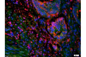 Immunofluorescence (IF) image for anti-Sterol O-Acyltransferase 2 (SOAT2) (AA 331-430) antibody (ABIN708476)