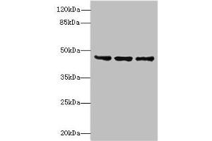 Western blot All lanes: FAM53B antibody at 2 μg/mL Lane 1: MCF-7 whole cell lysate Lane 2: A549 whole cell lysate Lane 3: HCT116 whole cell lysate Secondary Goat polyclonal to rabbit IgG at 1/10000 dilution Predicted band size: 46, 34 kDa Observed band size: 46 kDa (FAM53B Antikörper  (AA 1-305))