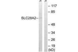 Western Blotting (WB) image for anti-Solute Carrier Family 28 (Sodium-Coupled Nucleoside Transporter), Member 2 (SLC28A2) (AA 371-420) antibody (ABIN2890646)