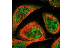 Immunofluorescent staining of human cell line A-431 with TERF2 polyclonal antibody  under 1-4 ug/mL working concentration shows positivity in cytoplasm & nucleus but excluded from the nucleoli. (TRF2 Antikörper)