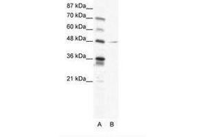 Image no. 1 for anti-Nuclear Factor I/C (CCAAT-Binding Transcription Factor) (NFIC) (AA 184-233) antibody (ABIN202501) (NFIC Antikörper  (AA 184-233))