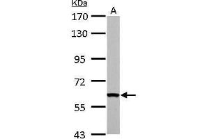WB Image FAST antibody detects FASTK protein by Western blot analysis. (FASTK Antikörper  (C-Term))