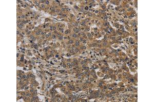 Immunohistochemistry of Human brain  using KIF4A Polyclonal Antibody at dilution of 1:40